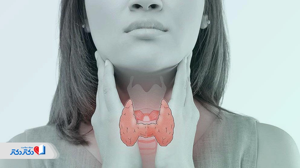 التهاب تیروئید (تیروئیدیت)؛ علل، علائم و راههای درمان