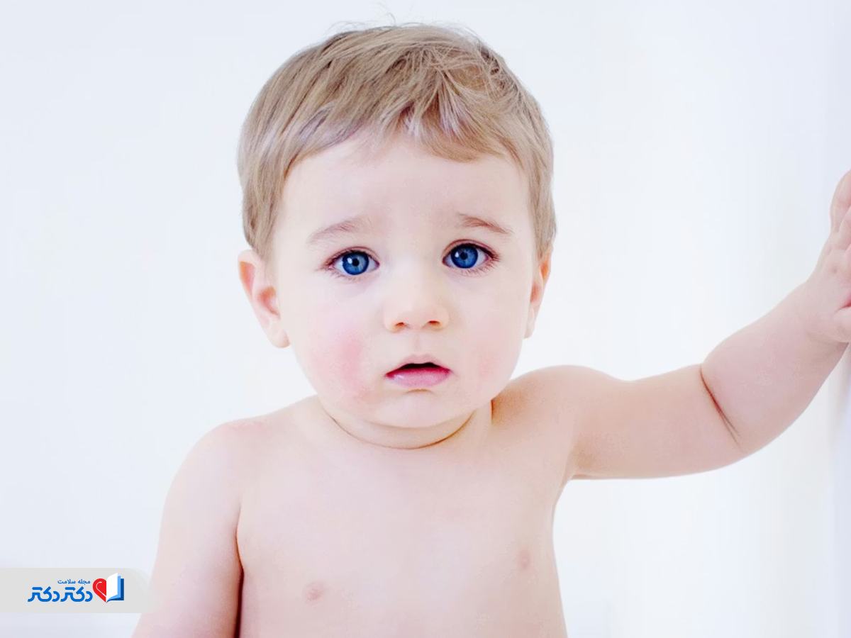 کم‌خونی کودکان و ضعف عمومی ناشی از خوردن شیر گاو