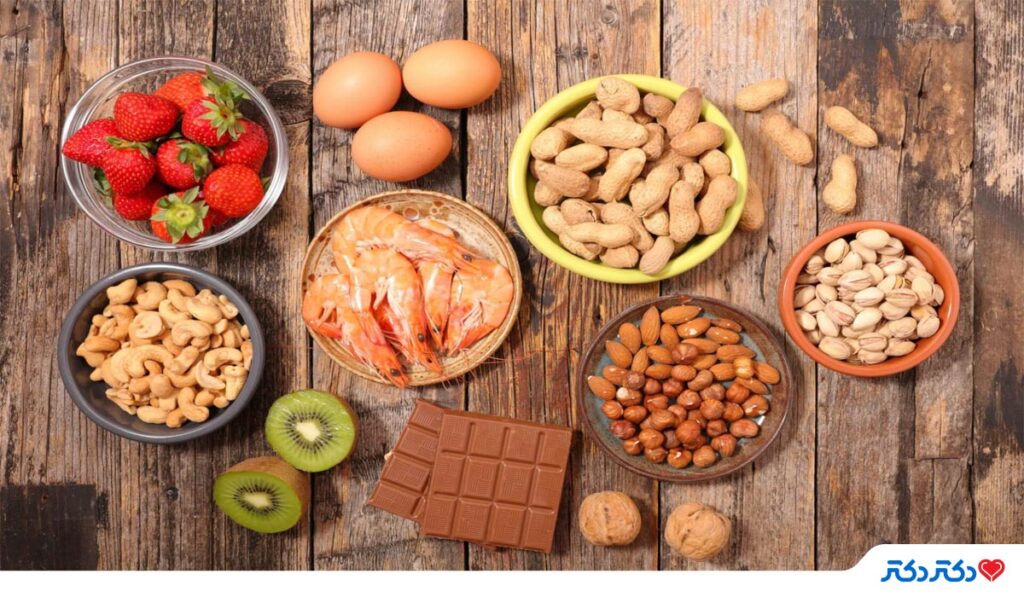 برای درمان کهیر چه بخوریم؟ بهترین خوراکی برای درمان کهیر مجله دکتردکتر برای درمان کهیر چه بخوریم؟ بهترین خوراکی برای درمان کهیر مجله دکتردکتر