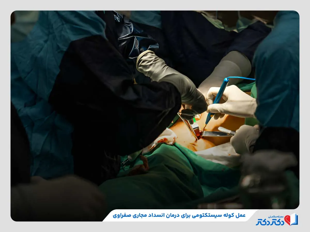 روش‌های درمان انسداد مجاری صفراوی مانند کوله سیستکتومی