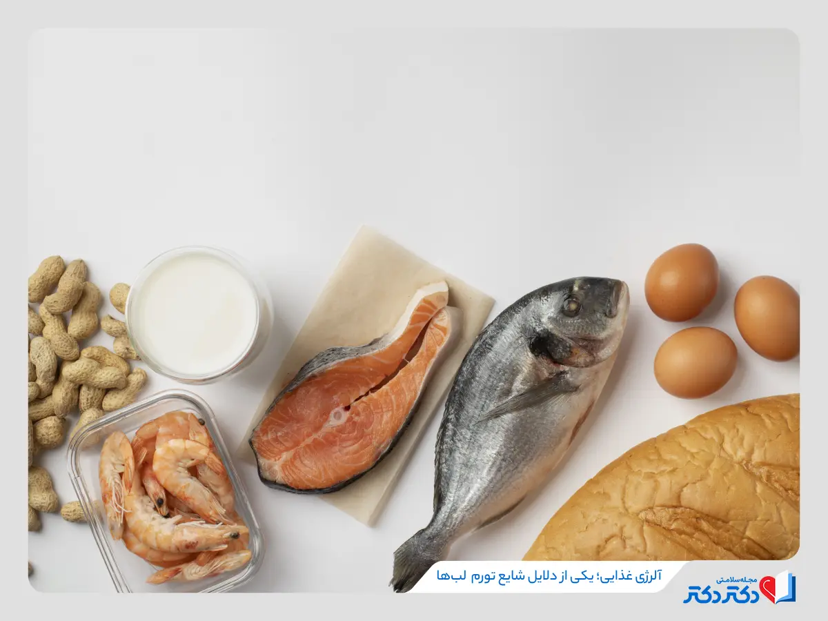آلرژی غذایی، یکی از انواع حساسیت‌هاست که منجر به ورم لب ها میشود.