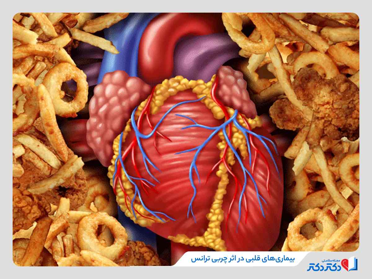 مضرات چربی ترانس چیست؟