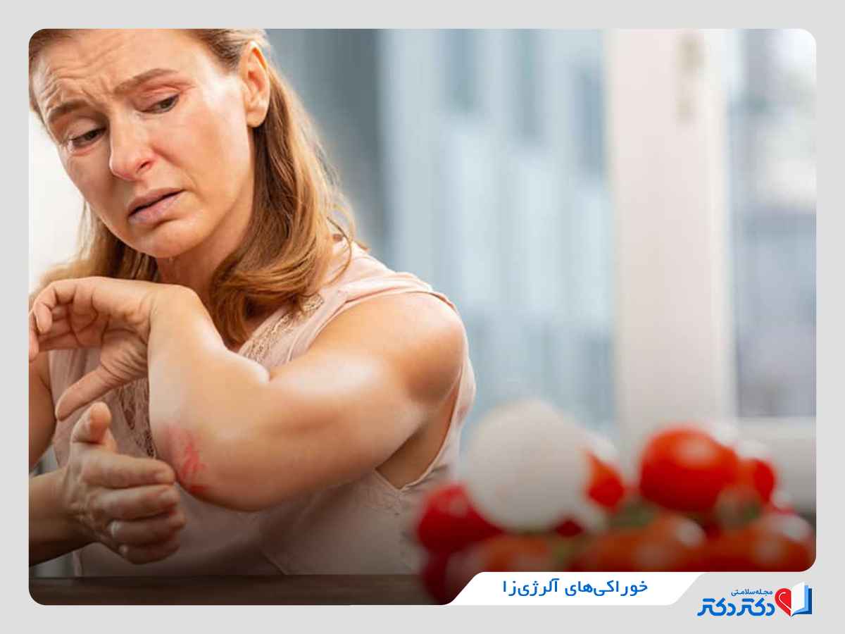 خوراکی‌های حساسیت‌زا و نامناسب برای کهیر