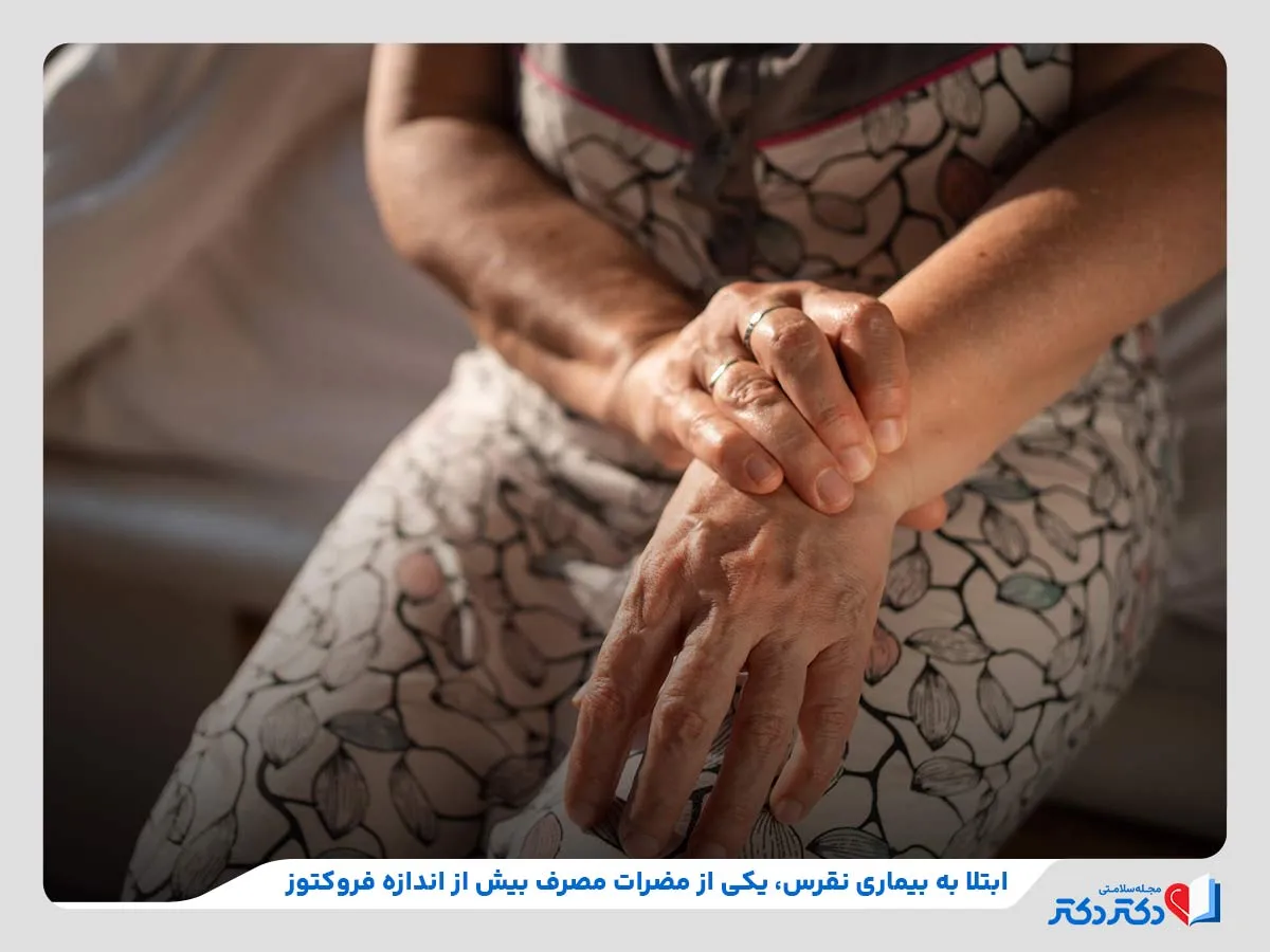 ابتلا به نقرس در نتیجه مصرف بیش از اندازه منابع فروکتوز 