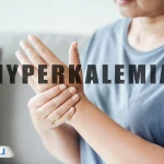 هیپرکالمی (پتاسیم خون بالا) چیست؛ علل، علائم و درمان