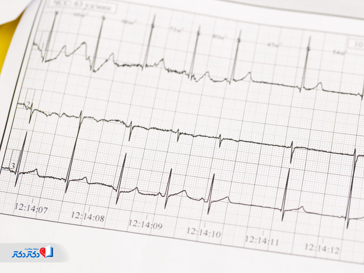 تغییر در ساختار قلب و در درازمدت خستگی قلب از عوارض هیپرکالمی