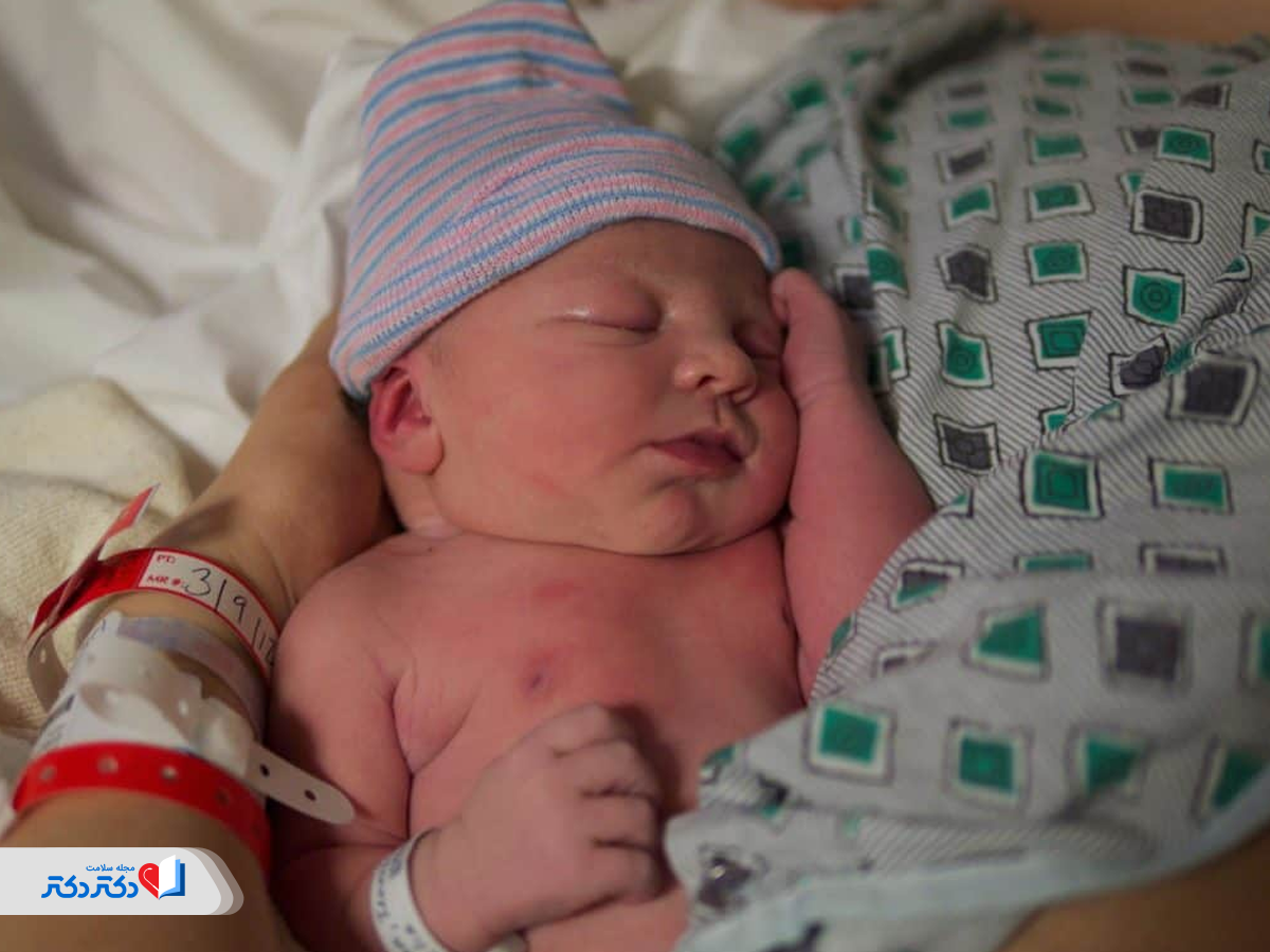 هیپرکالمی در نوزادان