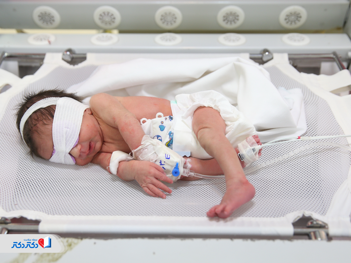 دیالیز برای درمان پتاسیم خون بالا در نوزاد