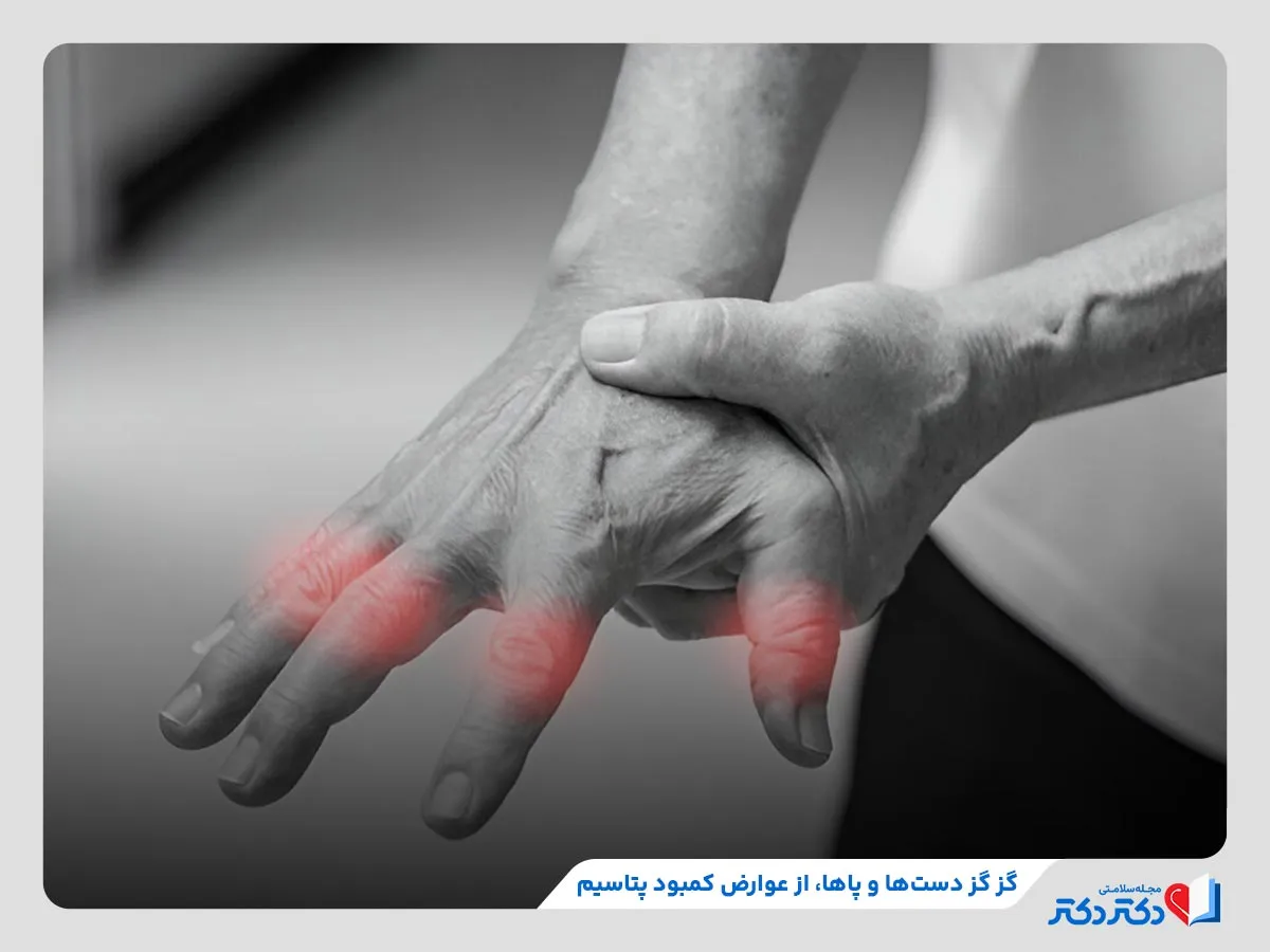 بروز احساس گزگز در دست‌ها و پاها در صورت کمبود پتاسیم 