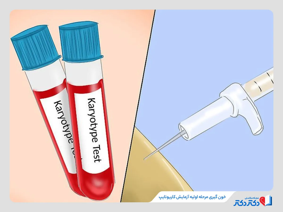 مراحل انجام آزمایش کاریوتایپ