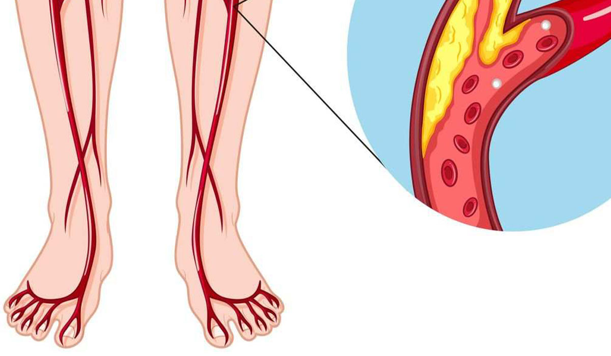 افزایش گردش خون در پاها