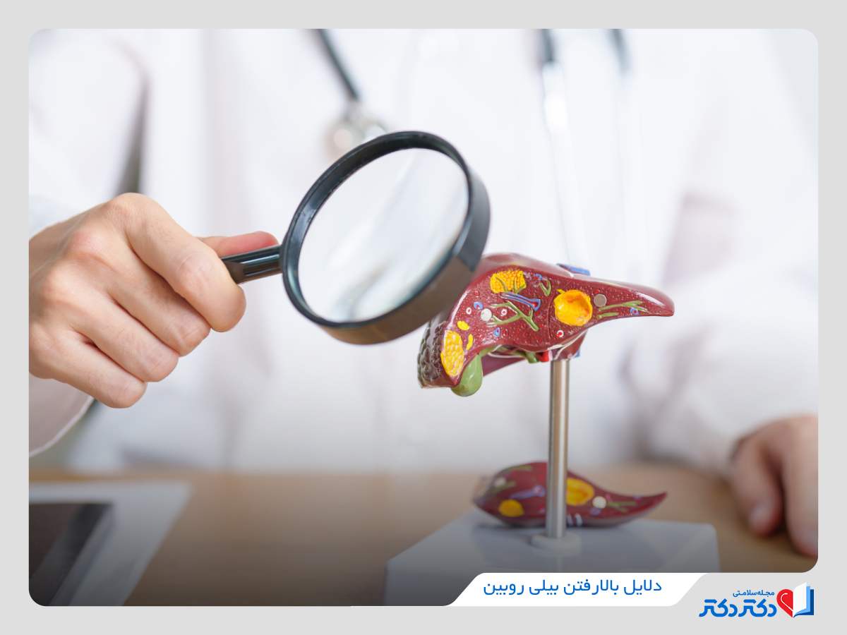 علت افزایش بیلی روبین