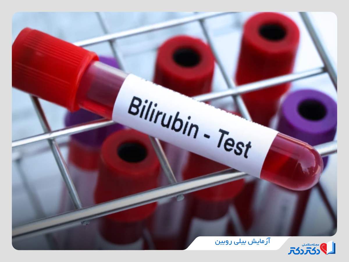آزمایش بیلی روبین