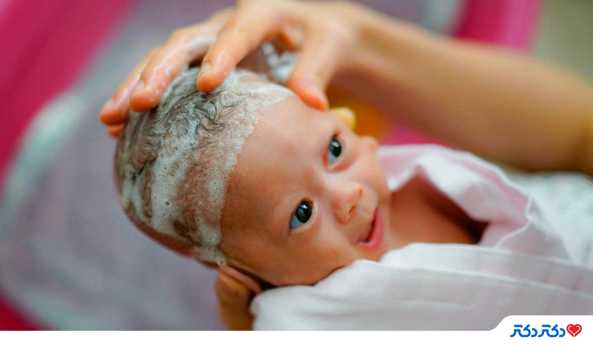 درمان درماتیت سبورئیک در نوزادان