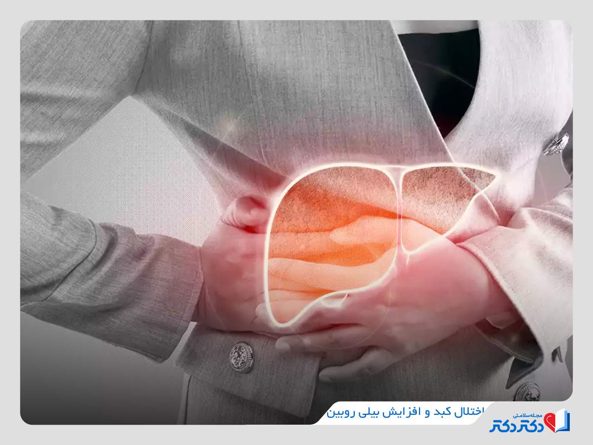 اختلال عملکرد کبد و افزایش بیلی روبین