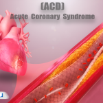 ACS چیست؟ علائم، تشخیص و درمان سندرم حاد کرونری