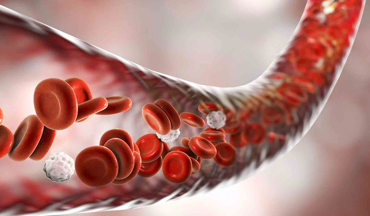 مسمومیت خون چیست؛ علت، علائم و روش های درمان