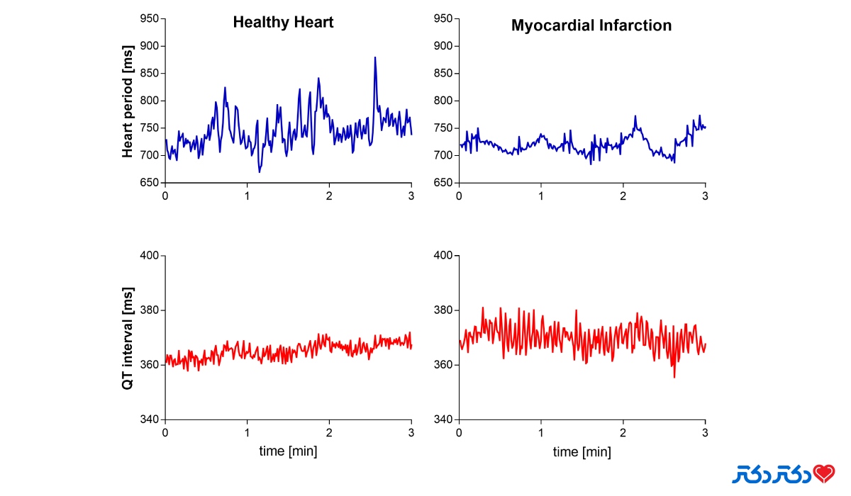 مقایسه ضربان های مختلف قلب