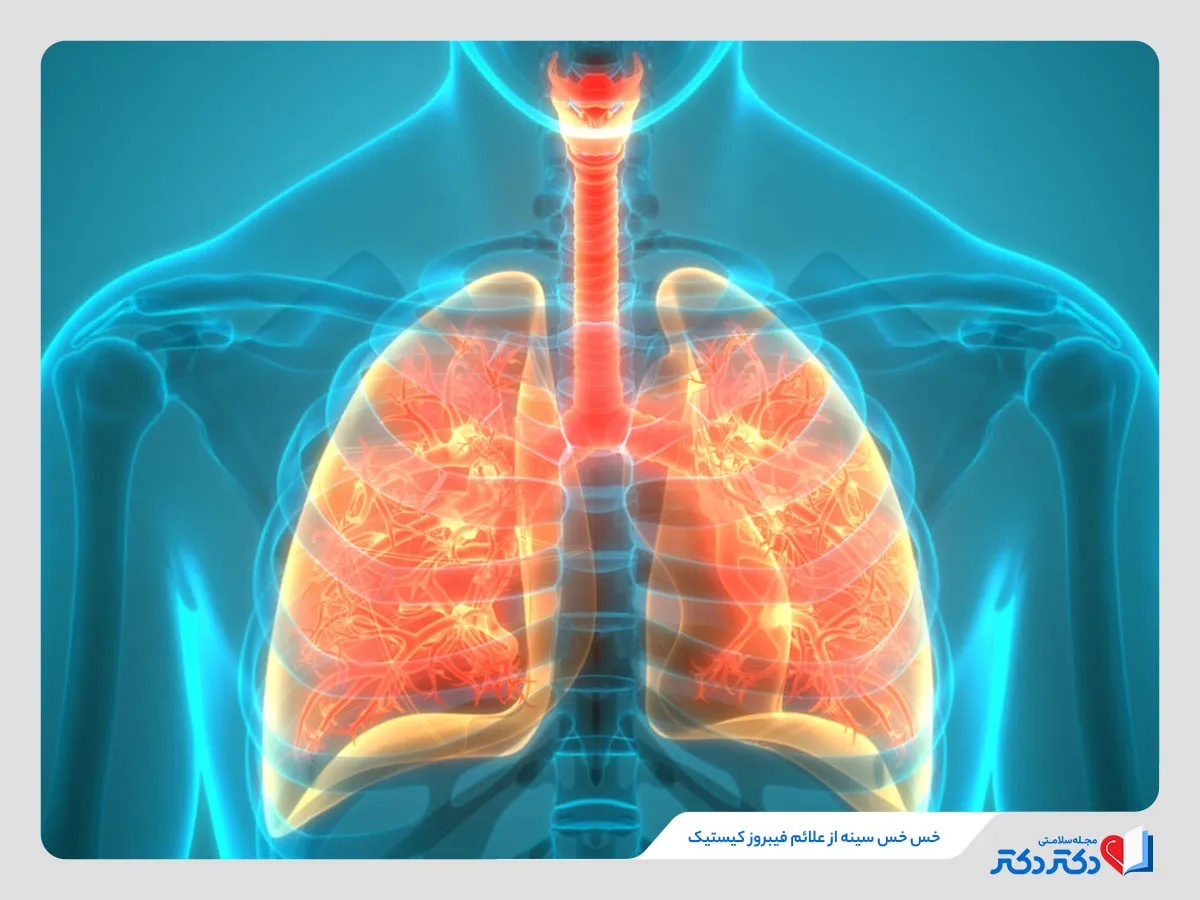 علائم تنفسی فیبروز سیستیک