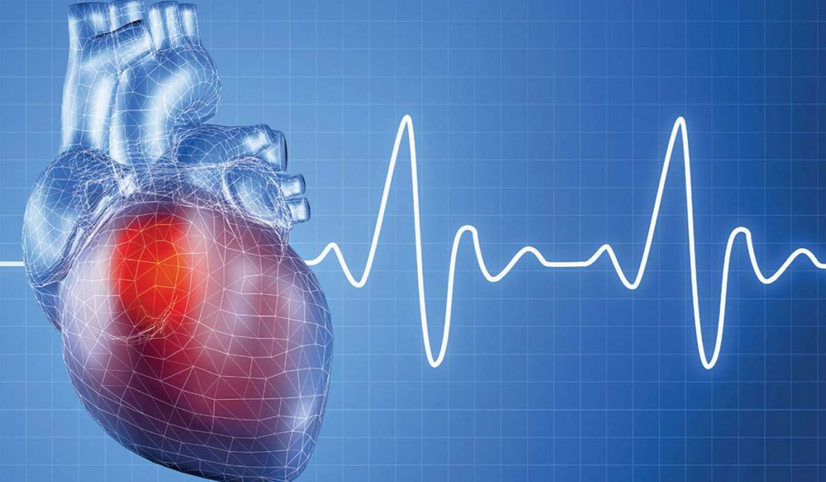 بعد از حمله قلبی چه اتفاقی می افتد؟