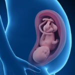 پایین بودن سر جنین در بارداری؛ علائم و نشانه ها، انواع