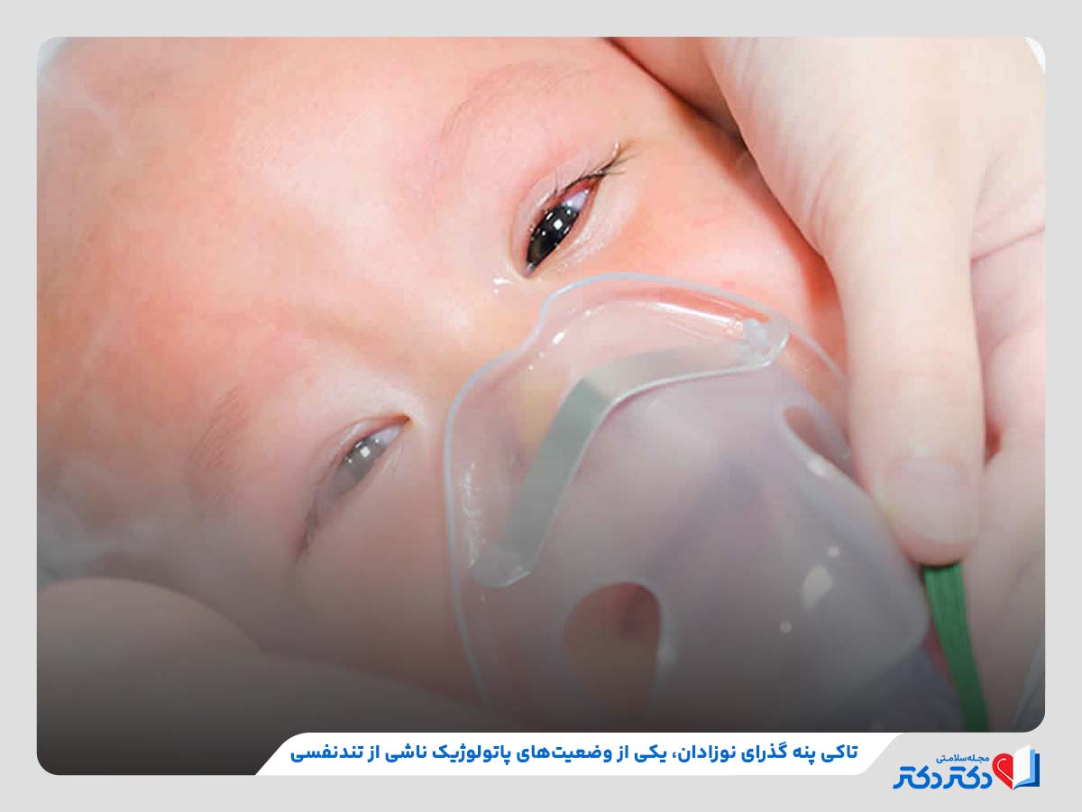 بررسی نکات مهم در خصوص تاکی پنه گذرای نوزادان