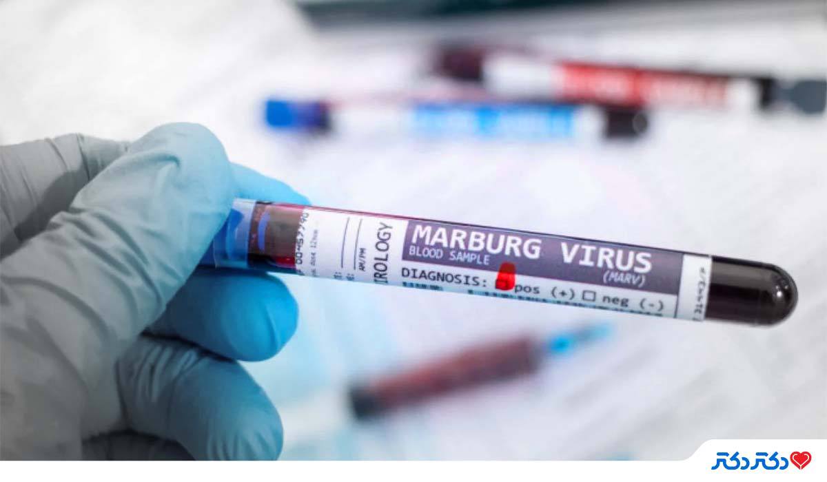 ویروس ماربورگ در آزمایشگاه