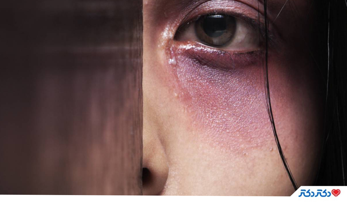 خشونت خانگی زنان