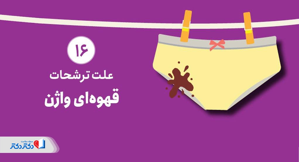علت ترشحات قهوه‌ای واژن چیست؟ از پریود تا بیماری