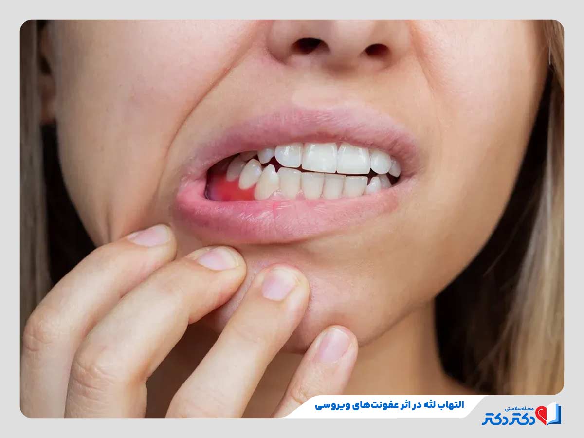 زن مبتلا به التهاب لثه و دندان درد در سرماخوردگی به دلیل عفونت‌های ویروسی