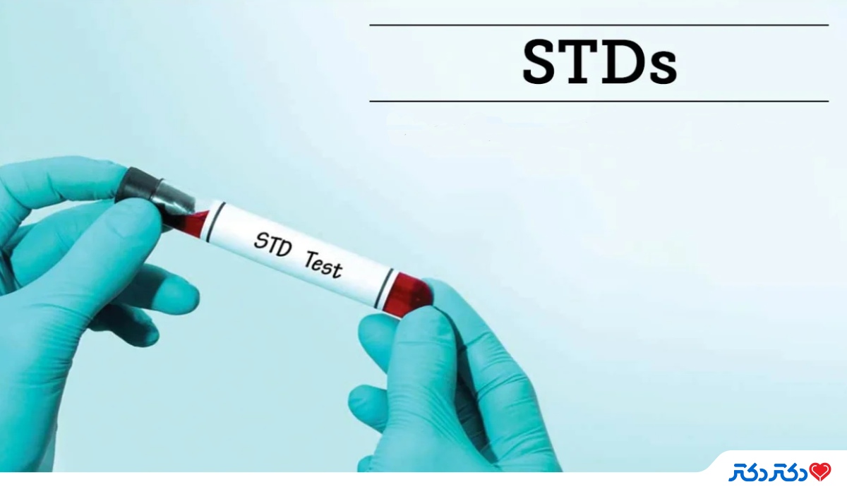 آزمایش تشخیص بیماری های مقاربتی STD
