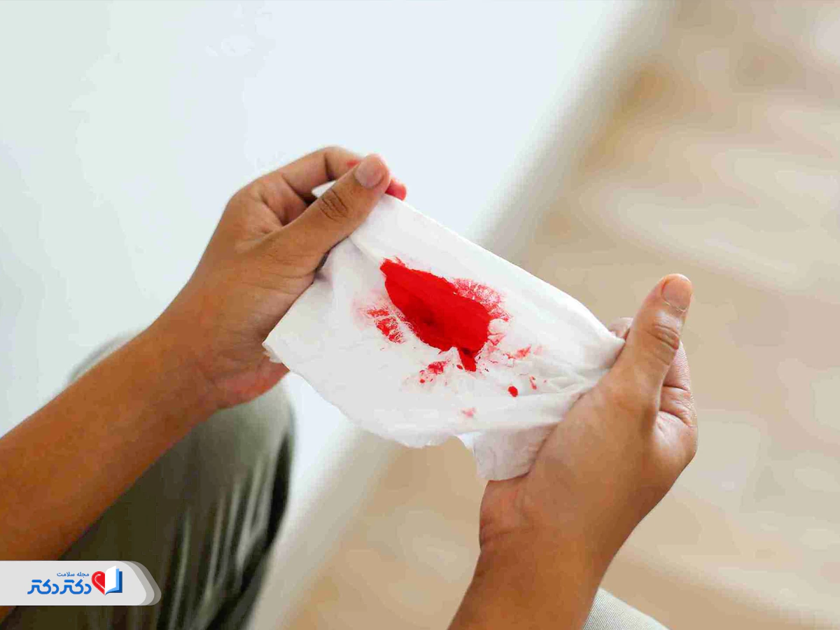 خونریزی از عوارض زایمان سزارین
