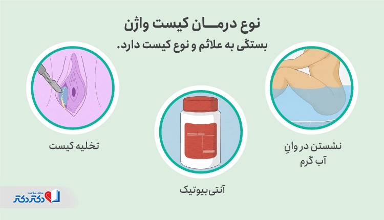 انواع روشهای درمان کیست واژن
