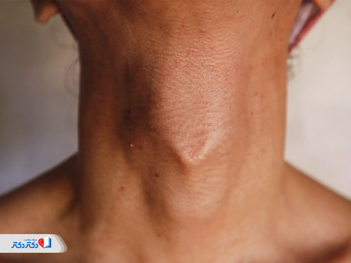 عوضشدن صدای پسران در سن بلوغ