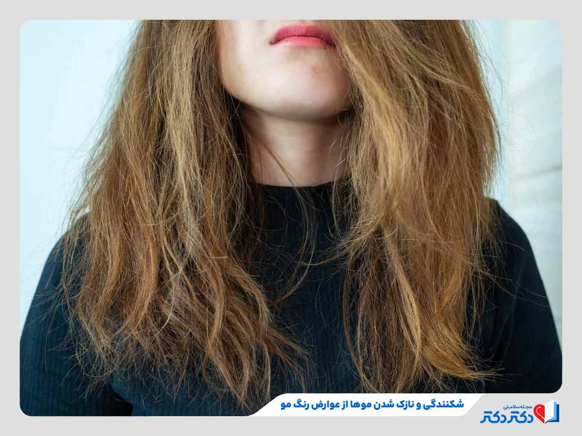 فرد دچار شکنندگی موها در اثر عوارض رنگ مو