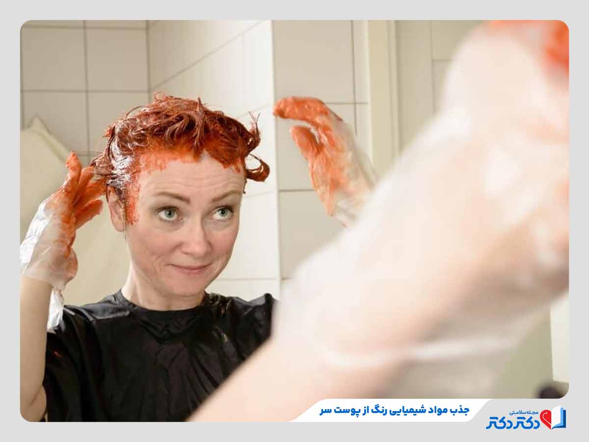ابتلای فرد به واکنشهای آلرژیک به دلیل عوارض رنگ مو
