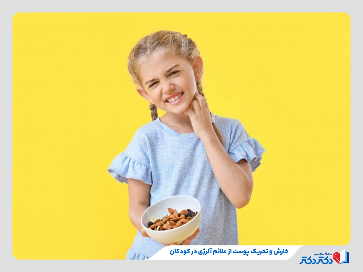 کودک مبتلا به خارش و نیازمند به درمان با روش‌های درمان آلرژی کودکان