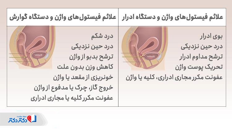 علائم فیستول واژن