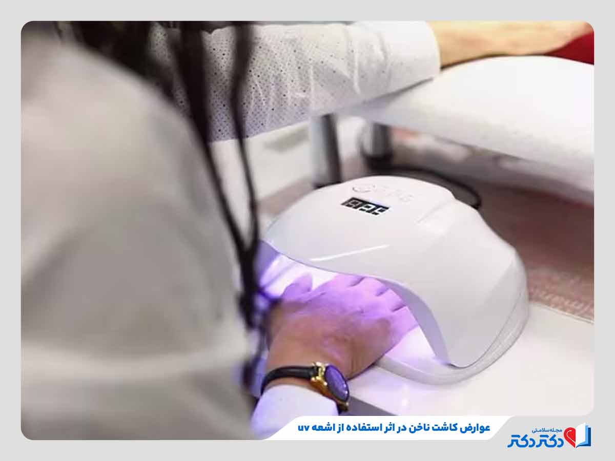 فرد مبتلا به عوارض کاشت ناخن در اثر قرار گرفتن در معرض اشعه uv