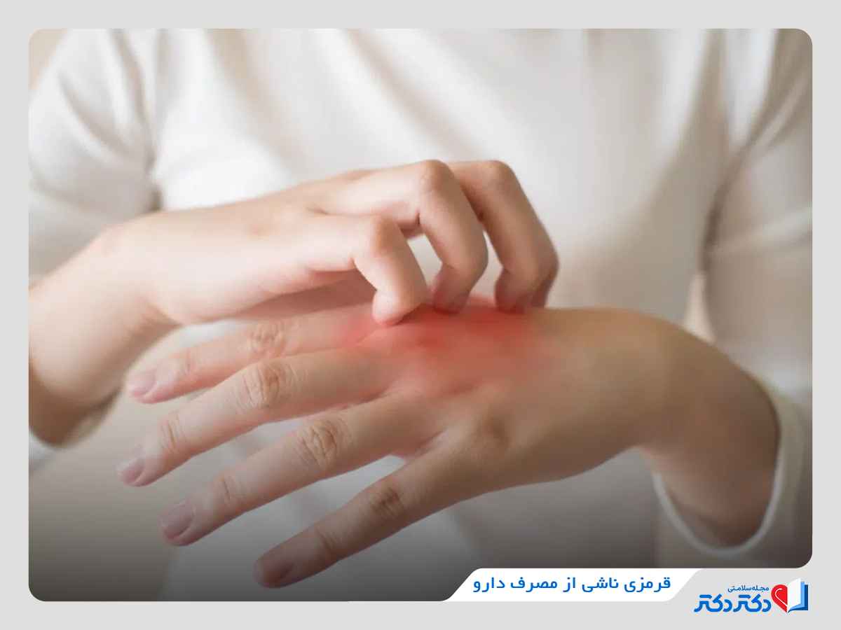 مصرف بعضی داروها، علت قرمزی پوست