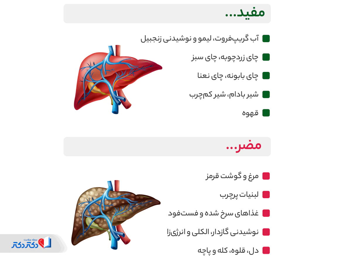 غذاهای مفید و مضر برای کبد چرب