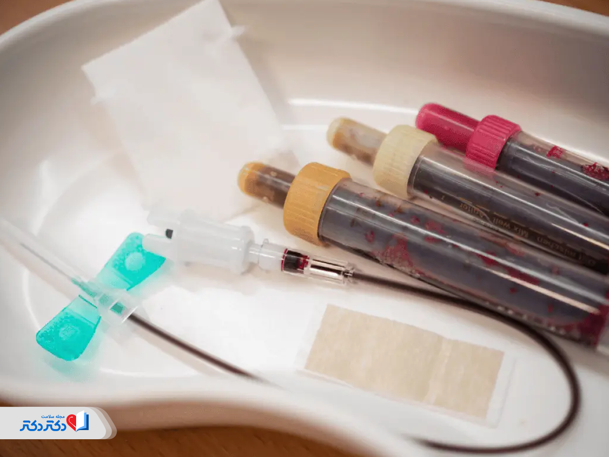 آزمایش خون برای تشخیص ابتلا به زگیل تناسلی