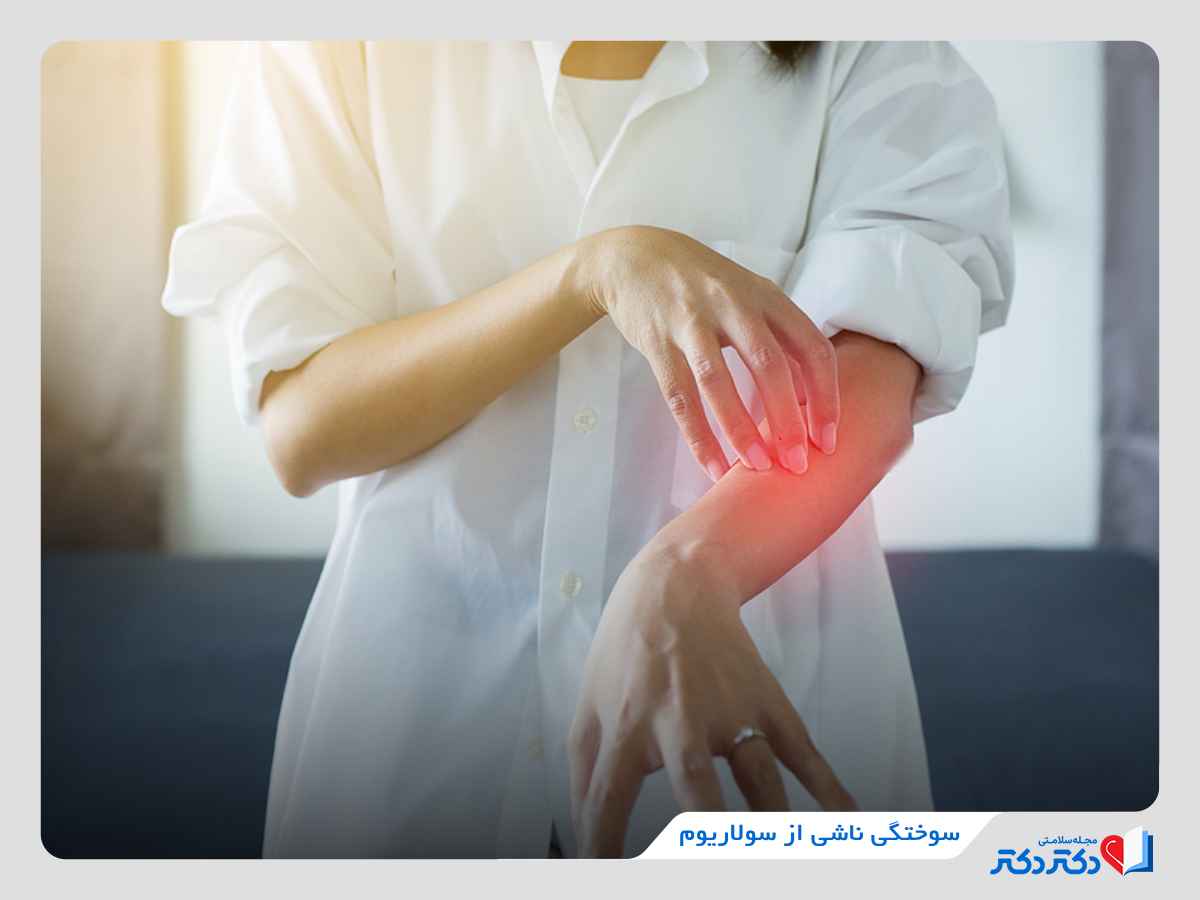 قرمزی پوست ناشی از سولاریوم