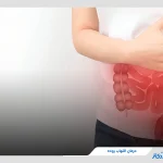بررسی کامل روش‌های درمان التهاب روده + نکات مهم