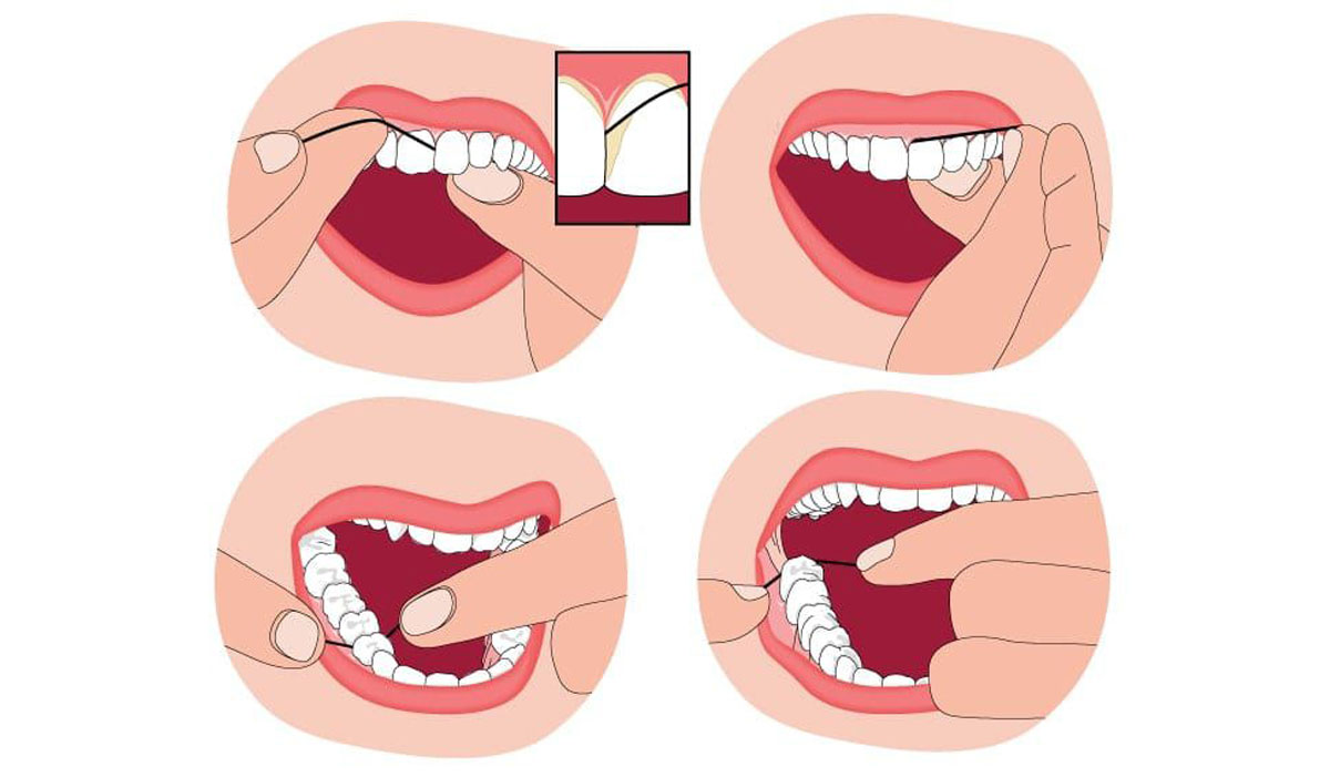 شیوه درست نخ دندان کشیدن