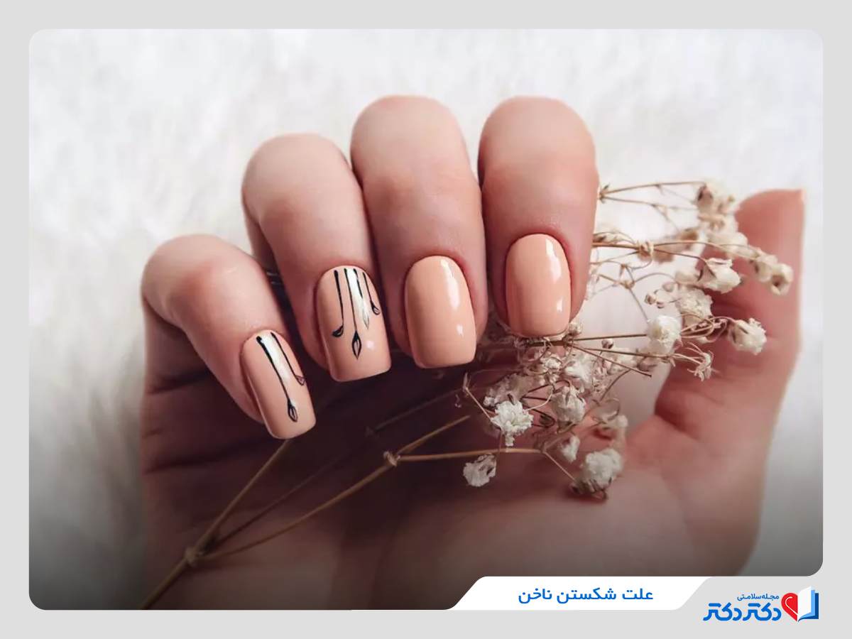 دلیل شکستن ناخن