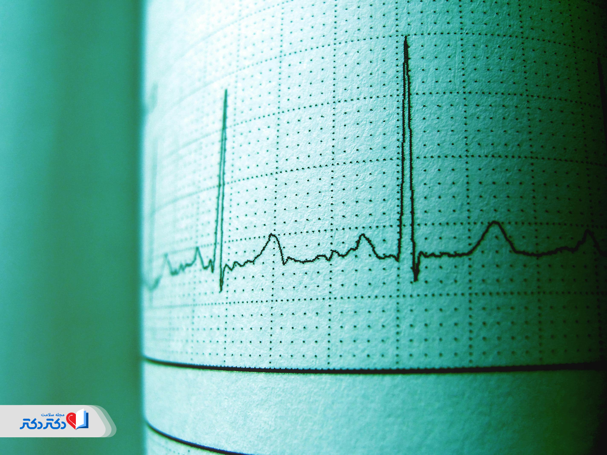 فلوکستین و تأثیر آن بر سیستم الکتریکی قلب