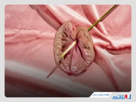 عفونت واژن در زنان؛ علائم و روش درمان عفونت واژن در خانه