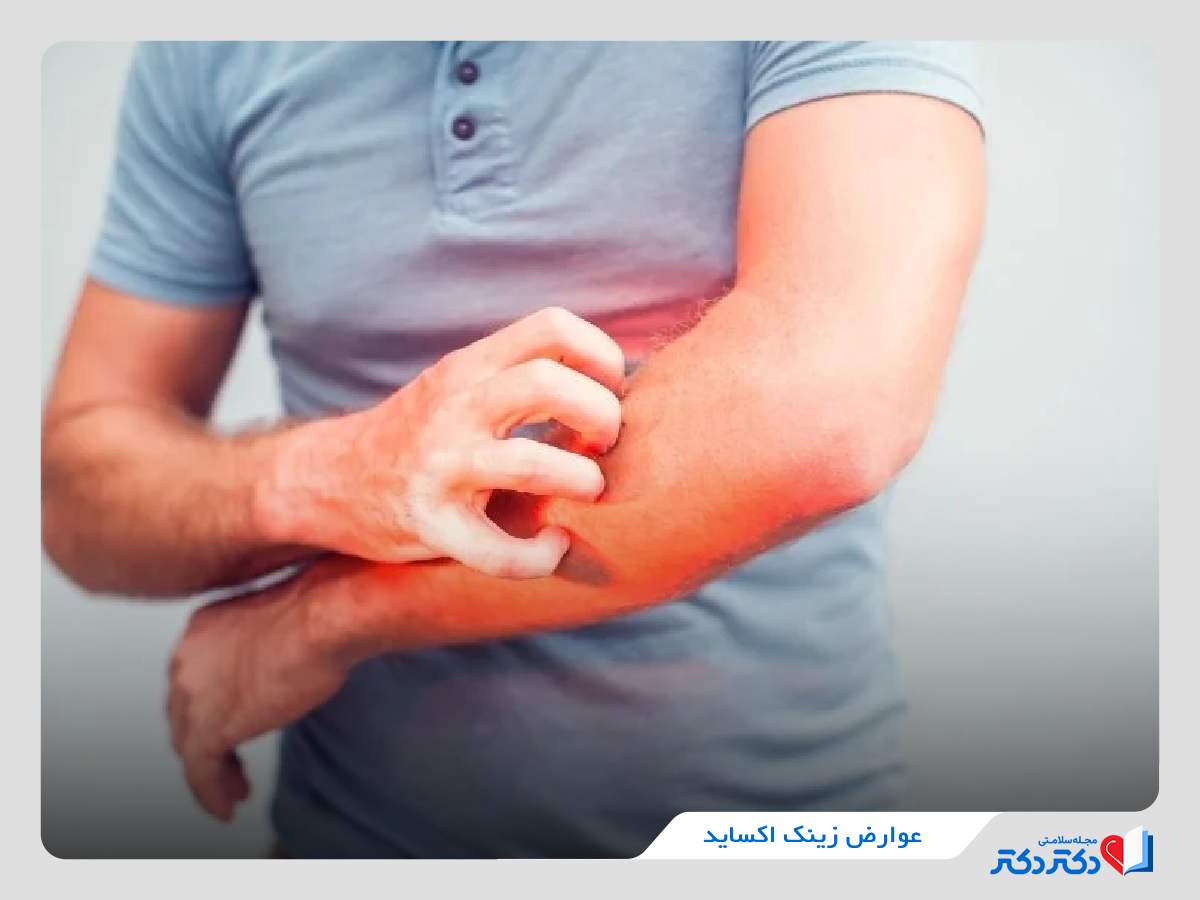 عوارض پماد زینک اکساید