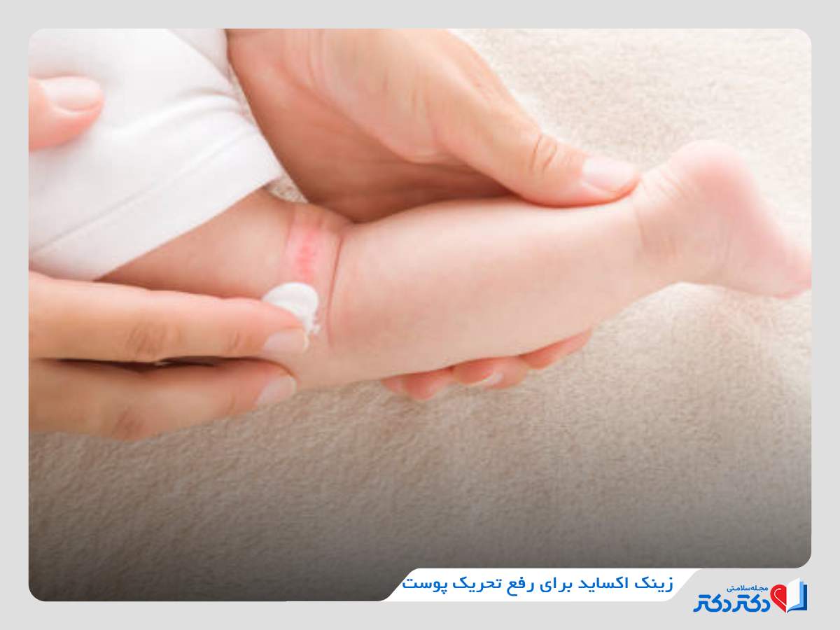 زینک اکسید برای تحریکات پوستی